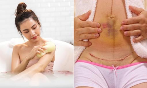 Mẹ sinh mổ bao lâu mới tắm được? Nếu bạn làm tốt những điều này, việc phục hồi sau sinh có thể sẽ thuận lợi hơn!