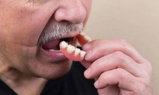 Căn bệnh mà bạn không chú ý đến khi còn trẻ này thực sự có thể khiến bạn mất hết răng! 