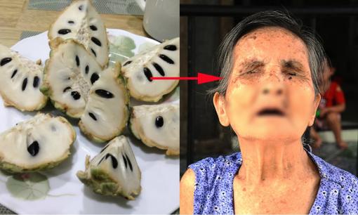 Quả na cực ngon và bổ dưỡng nhưng có một bộ phận gây ngộ độc, thậm chí là mù mắt, 90% người ăn chủ quan vì không biết