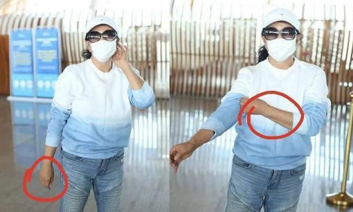 Ở tuổi 65, 'quốc bảo' Lưu Hiểu Khánh không giấu được tuổi tác, bàn tay phù như sưng tấy, da dẻ chảy xệ, xuất hiện nhiều vết đồi mồi