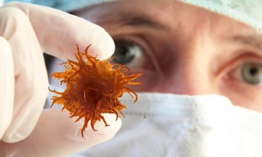 Ung thư di căn nhanh như thế nào? Nhắc nhở: Khi ung thư lan rộng, 4 loại bất thường có thể xảy ra trong cơ thể