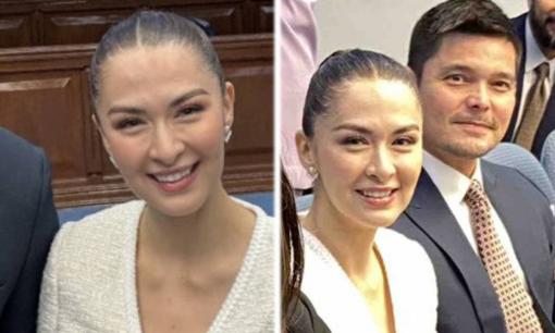 'Mỹ nhân đẹp nhất Philippines' Marian Rivera dưới ống kính thường lộ rõ khuyết điểm