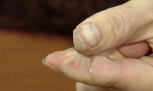 Keo 502 dính vào tay không thể tách rời, để tôi dạy bạn một mẹo, keo sẽ tan nhanh chóng, phương pháp rất đơn giản và thiết thực