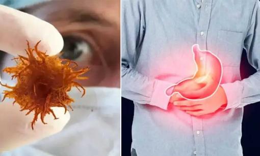 Mất bao lâu để chuyển từ viêm sang ung thư? Nhắc nhở: Tốt nhất bạn không nên trì hoãn 4 loại viêm này