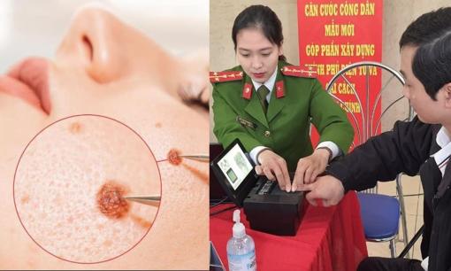 Tẩy nốt ruồi trên mặt có phải làm lại căn cước công dân không?
