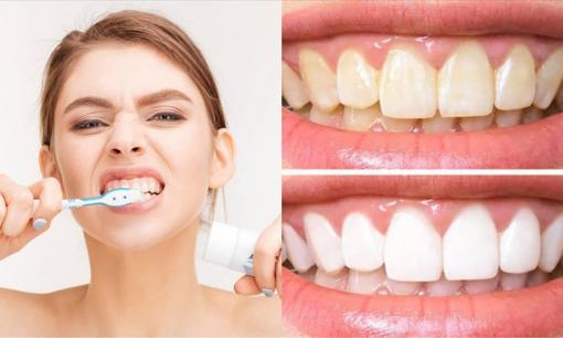 Bạn có thực sự biết cách đánh răng? Thứ quan trọng nhất cần chải khi đánh răng thực chất không phải là răng