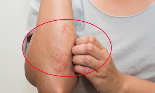 Bất kể nam hay nữ, nếu có hai triệu chứng ở cánh tay thì rất có thể là ung thư, nên đi khám và điều trị càng sớm càng tốt