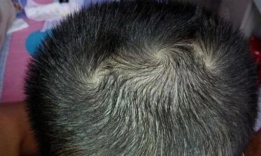 Ai có vòng xoáy quý tướng trên người sung sướng cả đời, vòng xoáy quý tướng là gì? 