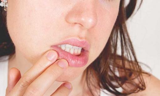 Môi xuất hiện 4 dấu hiệu này cảnh báo sức khỏe đang có vấn đề, 3 trong số đó rất thường thấy nhưng bạn đang ít quan tâm đến nó