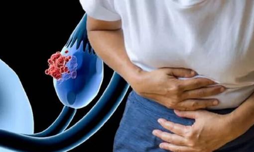 Ung thư buồng trứng thường được phát hiện muộn? Bác sĩ: Nếu 4 dấu hiệu sớm này xuất hiện trên cơ thể, bạn cần phải đi khám chữa kịp thời!