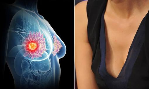 Ngực con gái có bao nhiêu hình dạng? Kiểu nào thì khỏe mạnh hơn?