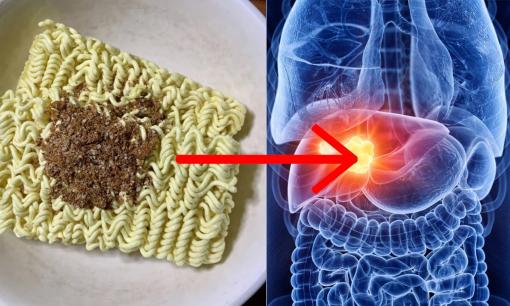 Hãy ngừng ăn 7 loại mì này! Chúng sẽ làm tổn thương gan thận và nuôi dưỡng các tế bào ung thư