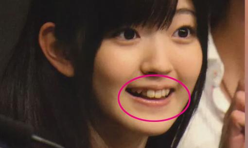 Tại sao hầu hết người Nhật đều có hàm răng không đều? Nguyên nhân khiến nhiều người bất ngờ