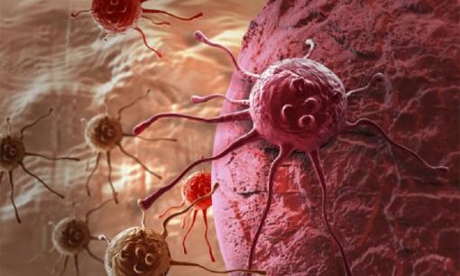 Bệnh nhân ung thư thường có 7 đặc điểm chung, nếu bạn có một trong số đó hãy thay đổi sớm để tránh tế bào ung thư 'tìm đến nhà'