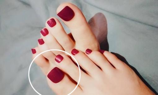 Người xưa có câu: Nếu ngón chân thứ hai dài hơn ngón cái, chứng tỏ không hiếu thảo với cha mẹ. Điều đó có đúng không?