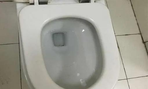 Mỗi lần đi vệ sinh, phân của tôi dính vào bồn cầu, có phải cơ thể tôi có vấn đề gì không?