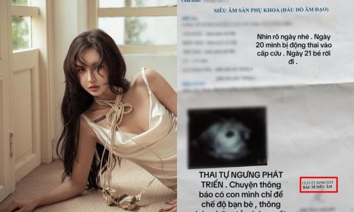 Sau ồn ào hôn nhân với  Decao, Lâm Minh bất ngờ hé lộ lý do mất đứa con thứ 2 gây xót xa