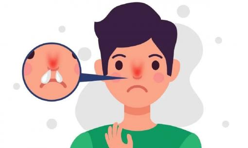 Tại sao nước mũi có lúc vàng, có lúc trắng? Bài viết này hướng dẫn bạn cách nhận biết vấn đề sức khỏe dựa trên màu sắc của mũi! 