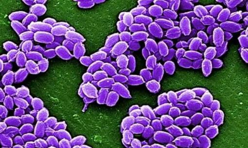 Lớp băng vĩnh cửu ở Bắc Cực tan chảy và những sinh vật bị đóng băng suốt 40.000 năm được hồi sinh. Liệu các loại virus cổ xưa có bùng phát? 