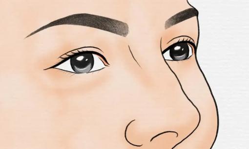 Nếu có ung thư trong cơ thể, mắt có thể nhận biết được? Nhắc nhở: Nếu mắt có 3 dấu hiệu này thì tốt nhất bạn nên đi kiểm tra