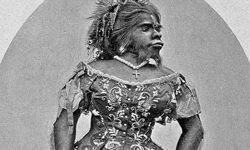 Người phụ nữ xấu nhất thế giới là ai?