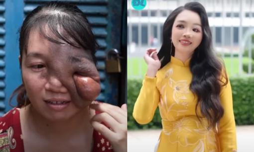 Người phụ nữ lột xác sau khi phẫu thuật khối u khiến chồng bật khóc