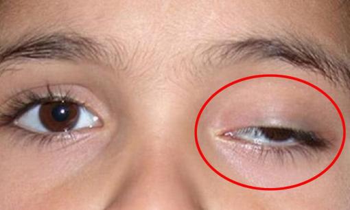 Giật mắt trái đối với nữ là hên hay xui?