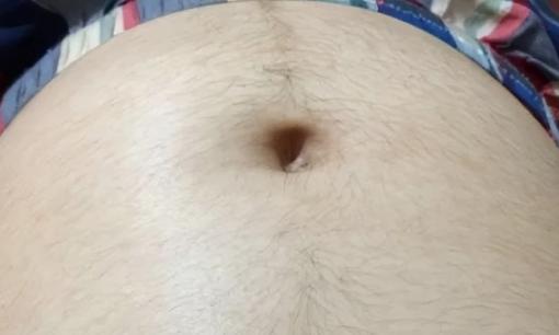 Tại sao phụ nữ mang thai lại mọc lông ở bụng? Có phải là dấu hiệu của việc mang thai con trai?