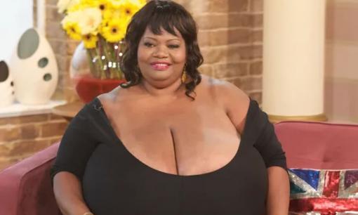 Người phụ nữ có bộ ngực tự nhiên to nhất thế giới: Nặng 60kg, dài hơn 1m và vẫn liên tục phát triển