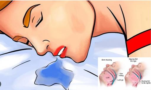 Vì sao bạn chảy nước dãi khi ngủ? Mẹo đơn giản để cải thiện ngay