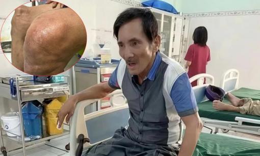 Thương Tín được người nhà đưa lên TP.HCM khám bệnh, nhìn chân của nam nghệ sĩ mà dân tình xót xa 