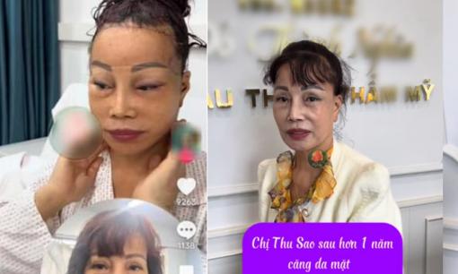 'Cô dâu 62 tuổi' Thu Sao hiện tại trông thế nào sau khi căng da mặt? 