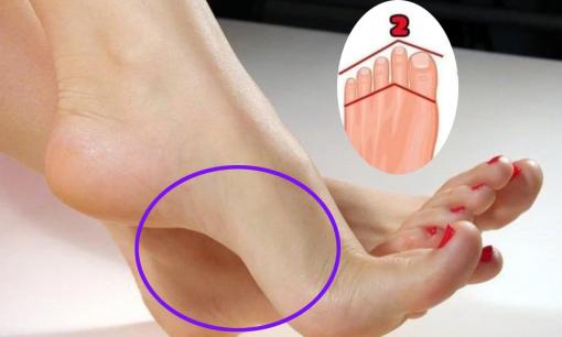 Bàn chân tiết lộ vận mệnh đại gia bí mật đằng sau đặc điểm này chính xác hơn cả khuôn mặt