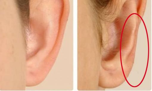 Nhìn tướng tai biết ngay ai giàu ai nghèo, sự khác biệt 'rõ mồn một'