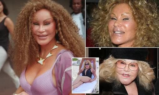 'Thảm họa dao kéo Mỹ' - 'Miêu nữ' tỷ phú Jocelyn Wildenstein qua đời