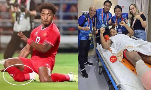 Tiền đạo Nguyễn Xuân Son gãy ống chân, tình hình hiện tại ra sao?