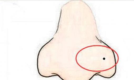 Trên khuôn mặt có 4 nốt ruồi không may mắn sẽ thu hút kẻ xấu, hủy hoại vận may của bạn, thậm chí loại bỏ một trong số chúng cũng vô ích!