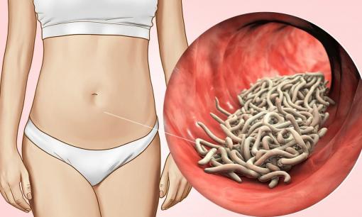 Cách đây vài chục năm, hầu hết mọi người đều có giun đũa trong bụng. Tại sao bây giờ người ta ít nghe nói đến? 