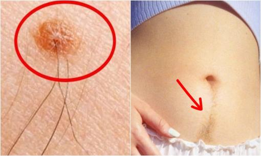 Người xưa khuyên: 'Có lông mọc ở 4 nơi này thì đừng nhổ bỏ, càng nhiều lông càng có phúc'