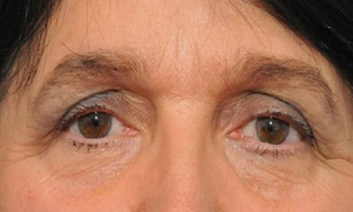 Nam nữ có tướng lông mày quặp xuống nói lên điều gì? 