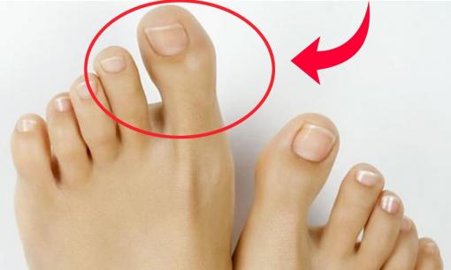 Sau 30 tuổi, tiền tài ùn ùn kéo đến nếu bạn có 4 tướng bàn chân 'thần tài' này, khám phá ngay vận mệnh của bạn