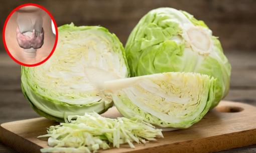 Ăn bắp cải có bị bướu cổ không? Chuyên gia giải đáp