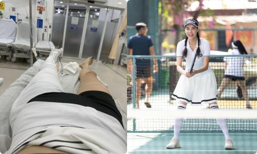Siêu mẫu Kỳ Hân gãy xương đùi, phải bó bột 