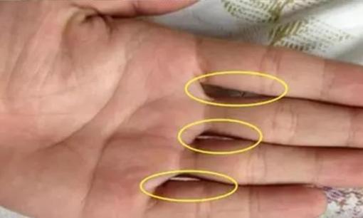 Ghép các ngón tay lại với nhau, xem bạn có bao nhiêu lỗ? Hóa ra nó có thể phản ánh cả tính cách và mức độ giàu có của bạn