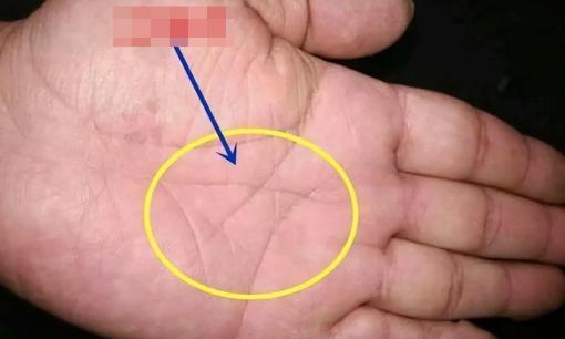 Có câu: 'Nếu bạn có đường chỉ tay hình tam giác, bạn sẽ giàu có đến năm 99 tuổi', vị trí của đường chỉ tay hình tam giác được tiết lộ, liệu có chính xác? 