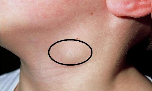 Chuyên gia y tế cảnh báo, sáng sớm thấy 4 dấu hiệu này là tế bào K đang tấn công, ăn mòn cơ thể