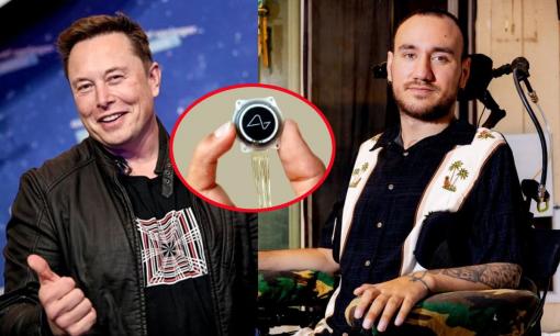 Hơn 1 năm sau khi được cấy chip não của Elon Musk, thanh niên 30 tuổi giờ sống thế nào?