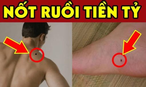 Vị trí 7 nốt ruồi là 'thần may mắn', nam nữ chỉ cần có 1 số cũng sướng như tiên