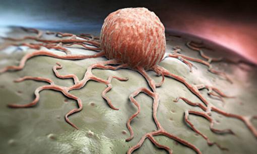 Tế bào ung thư rất thèm đường, liệu có chết đói nếu không có đường không? 1 cách tuyệt vời để phòng ngừa ung thư mà mọi người đều có thể làm