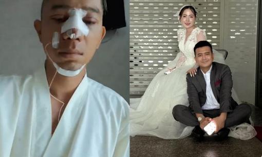 Sao Việt 25/6: Sức khỏe Lương Bằng Quang sau khi nhập viện; Hùng Thuận 'Đất Phương Nam' chính thức tung ảnh cưới